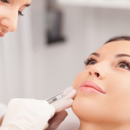 dermal-filler-post-2 dermal-filler-post-2